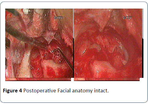 head-neck-cancer-Facial-anatomy